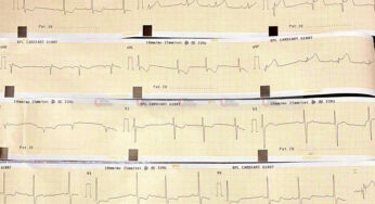 ಕುಕ್ಕೆ ಸುಬ್ರಹ್ಮಣ್ಯದಲ್ಲಿ ಬೇಕಿದೆ ECG Telemedicine ಯಂತ್ರ | ಮಂಗಳೂರಿನ ಖ್ಯಾತ ಹೃದಯತಜ್ಞ ಡಾ.ಪದ್ಮನಾಭ ಕಾಮತ್‌ ಅಭಿಮತ |