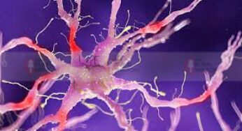 #Neuropathy |ನರಗಳ ಅಸ್ವಸ್ಥತೆ ಸಂಭವಿಸಿದ್ರೆ ನರರೋಗ ಖಂಡಿತಾ | ಇದಕ್ಕೆ ಆಯುರ್ವೇದ ಪರಿಹಾರ ಹೇಗೆ?